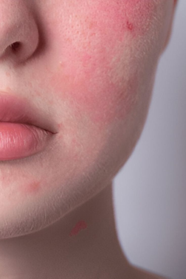 Prime Skin Analysis - Sensitive & Reactive Edition - Skin Prime Lab